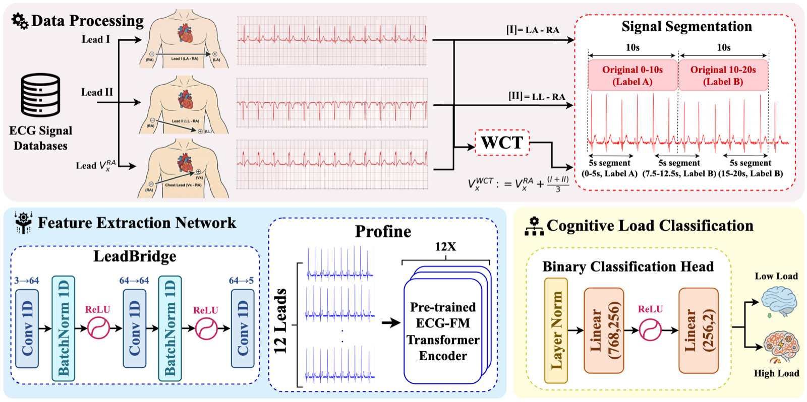 CogAdapt: Transferring Clinical ECG Foundation Models to Wearable Cognitive Load Assessment via Lead Adaptation