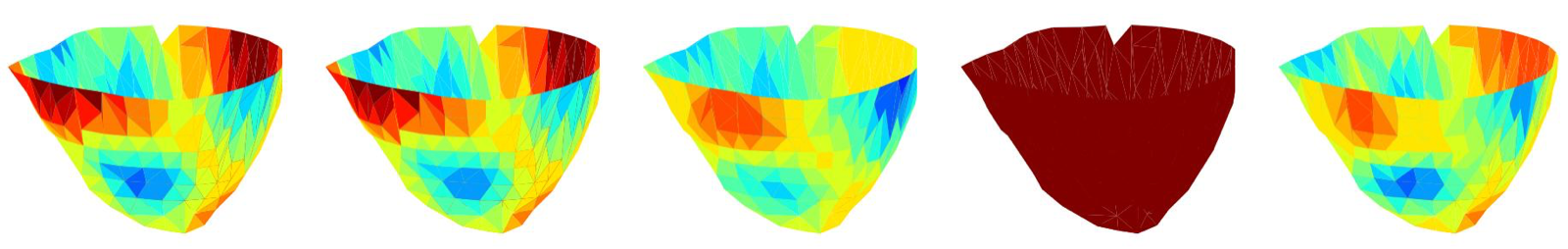 Learning Cardiac Electrophysiology Digital Twins Through Agentic Discovery of Hybrid Structure