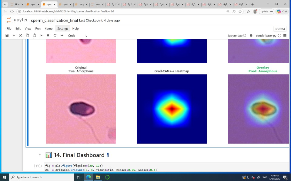 Interpretable Sperm Morphology Classification via Attention-Guided Deep Learning